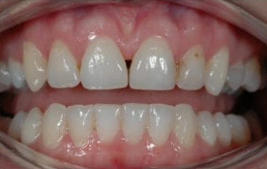 second image